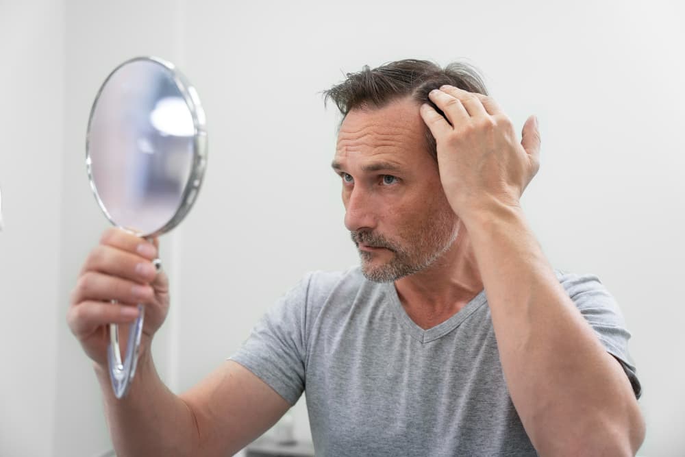 Tratamiento capilar para hombres en Barcelona