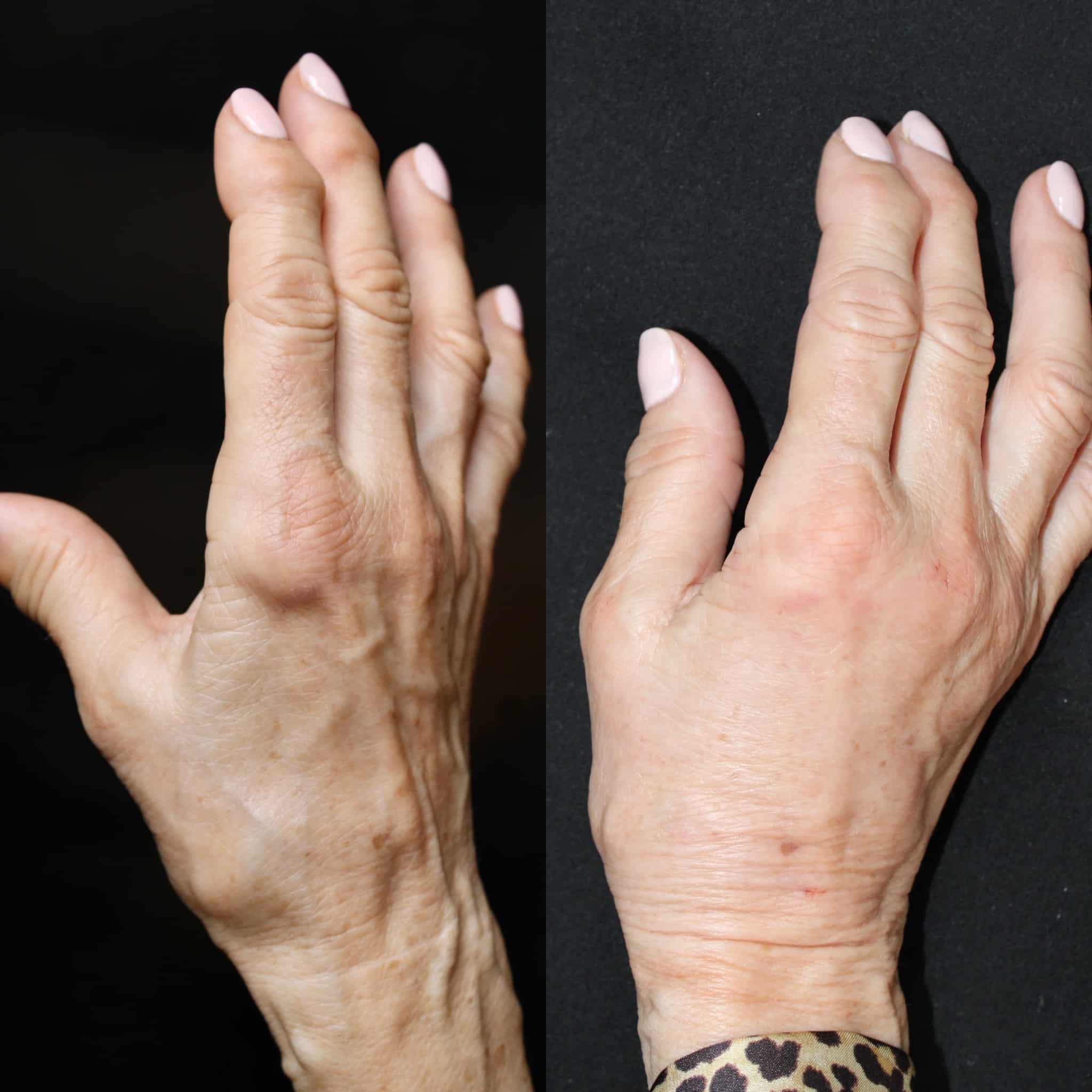 E1D5E84B-6209-41CA-9DB7-86FD625CE874